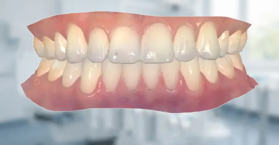 3D dental imaging